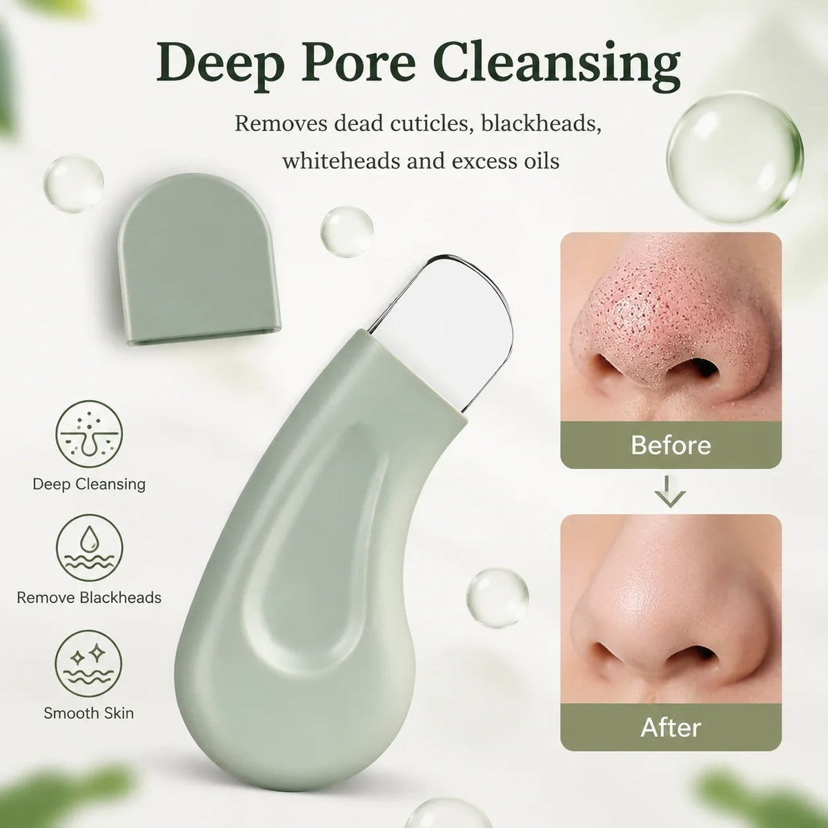 Black Head Remover